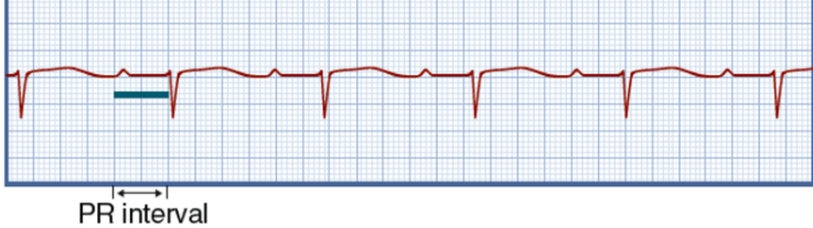 <p>What rhythm is this?</p>