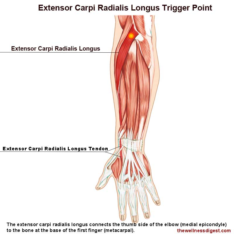<p>Extensor carpi radialis* ** (Muscles of the posterior forearm - wrist, hand, &amp; digit movement 1 of 3):</p><p>What is OIAS<span style="color: rgb(235, 7, 7);">A</span>?</p>