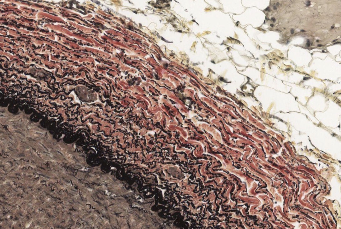 <p>Identify the Vessel and the Layer pictured</p>