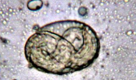 <p>what helminth is this?</p>