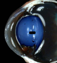 <p>• The lens is a soft, transparent structure made up of microscopic fibers that are arranged like the layers of an onion </p><p>• Elastic and biconvex </p><p>• Focus </p><p>• The process where the shape of the lens is changed by the ciliary body is called accommodation</p>