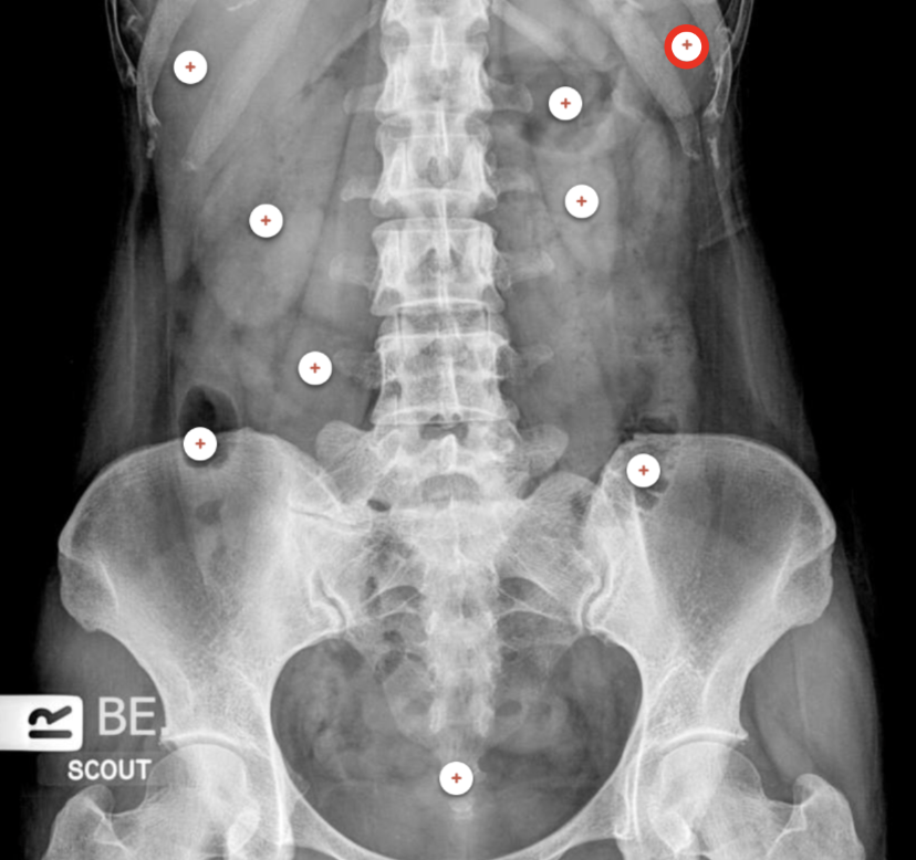 <p>what structure is the red circle labeling? </p>