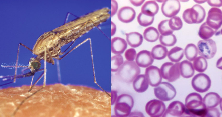 <p>Name the parasite-vector pair. What disease do they cause? How and where is it transmitted? What are the symptoms?</p>