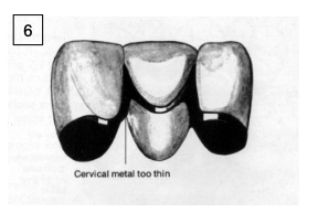 <p>linguocervical </p>