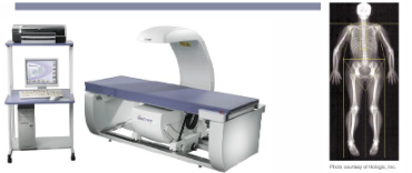 <p>What is DEXA scanning and what are its strengths and limitations for assessing body composition?</p>