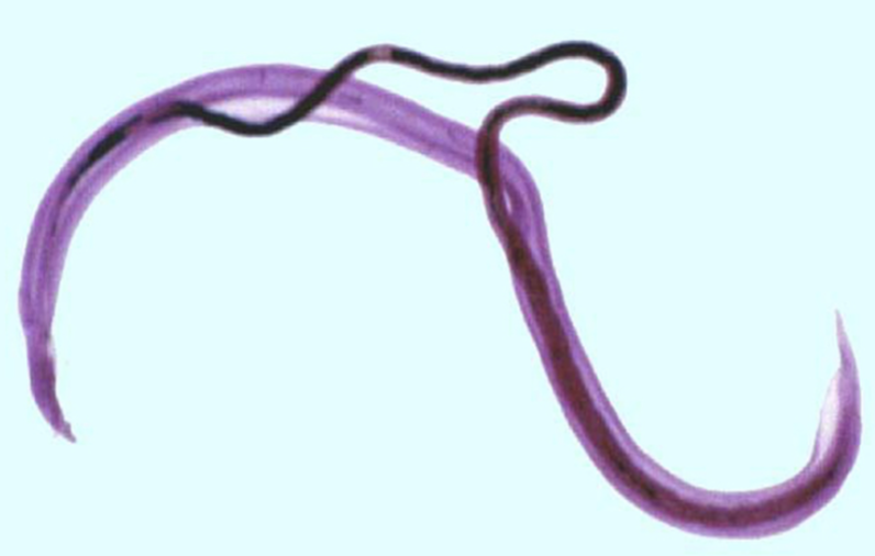 <p>What helminth/fluke/parasitic worm is this?</p>