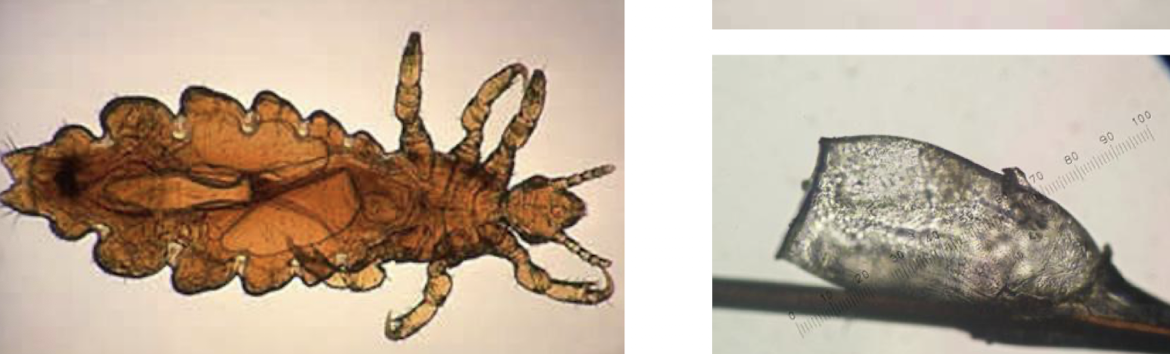 <p>What insect is this?</p>