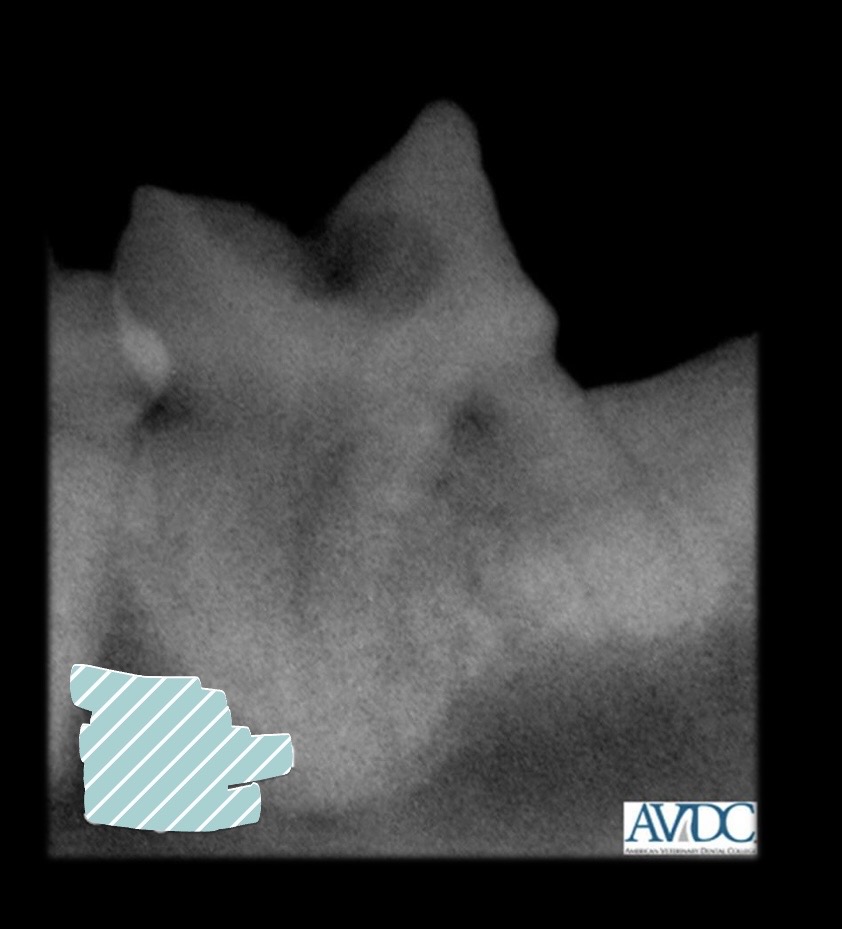 <p>what stage of tooth resorption is this?</p>