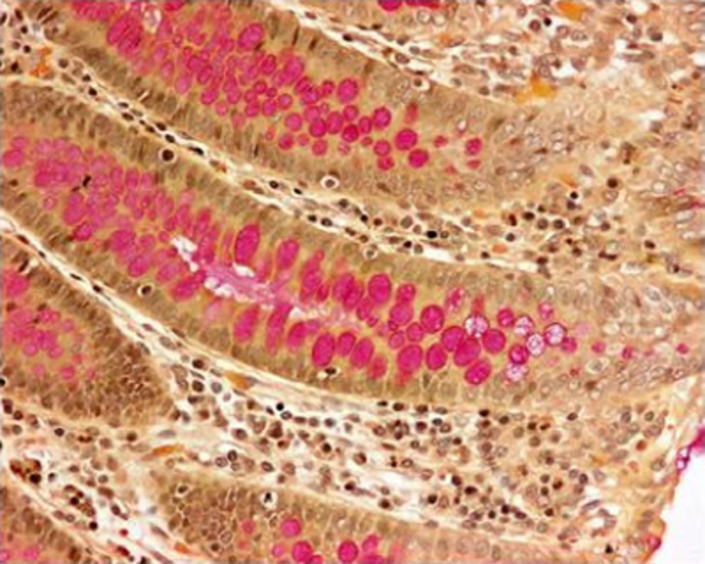 <p>mucicarmne</p><p>Feedback:</p><p>Mucicarmine has stained the mucin in the goblet cells red and the typical counterstains of iron hematoxylin and metanil yellow have been used. Congo red would not stain the goblet cells and aldehyde fuchsin would stain them purple. Although the PAS would stain goblet cells rose, the counterstains are not commonly used with the PAS, but are used with mucicarmne.</p>