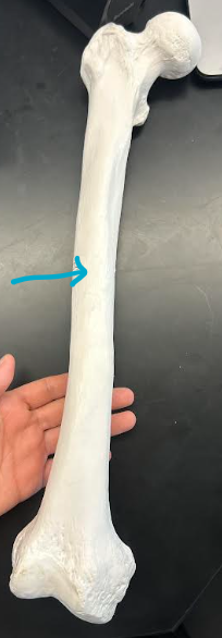 <p>ID femur/os coxae region </p>