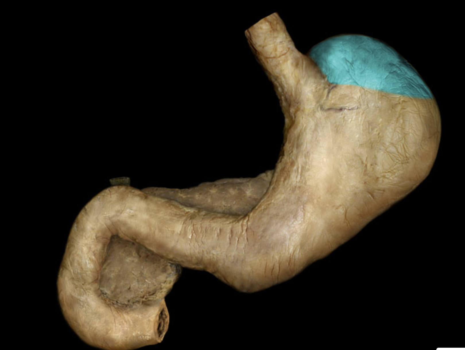 term image