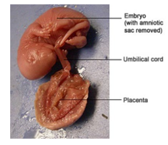 <p>This is the reproductive system of class Mammalia, specifically group ________. This rat embryo is oviparous <strong>OR</strong> viviparous.</p>