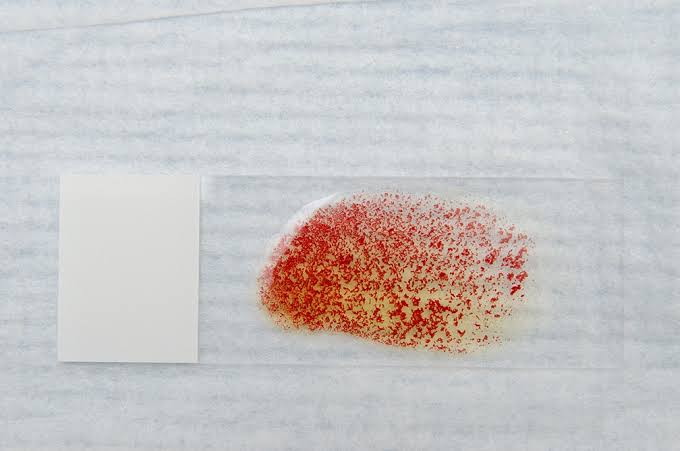 <p>Saline slide agglutination test</p>