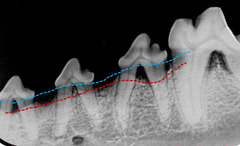 <p>What pattern of bone loss is this?</p>