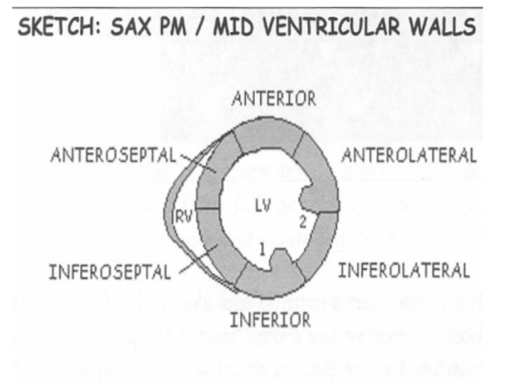 <p>PSAX Mid Level </p>