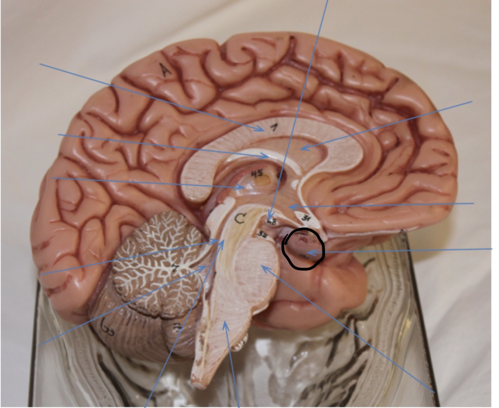 <p>Identify the circled area?</p>