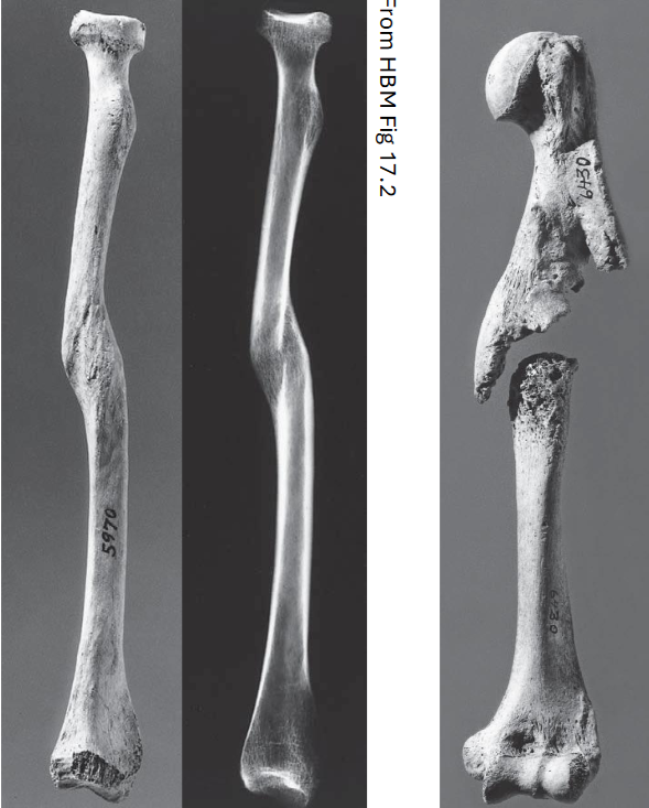 <p>How does bone heal?</p>