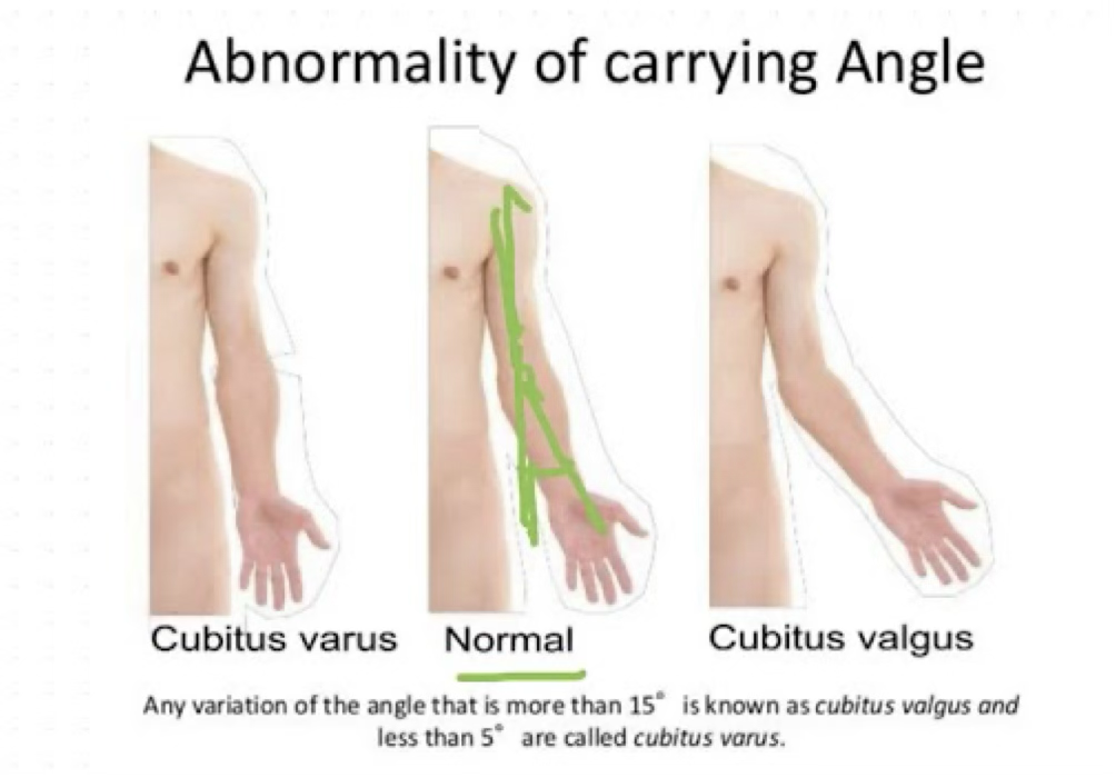 <p>what does the carrying angle of the elbow tell us?</p>