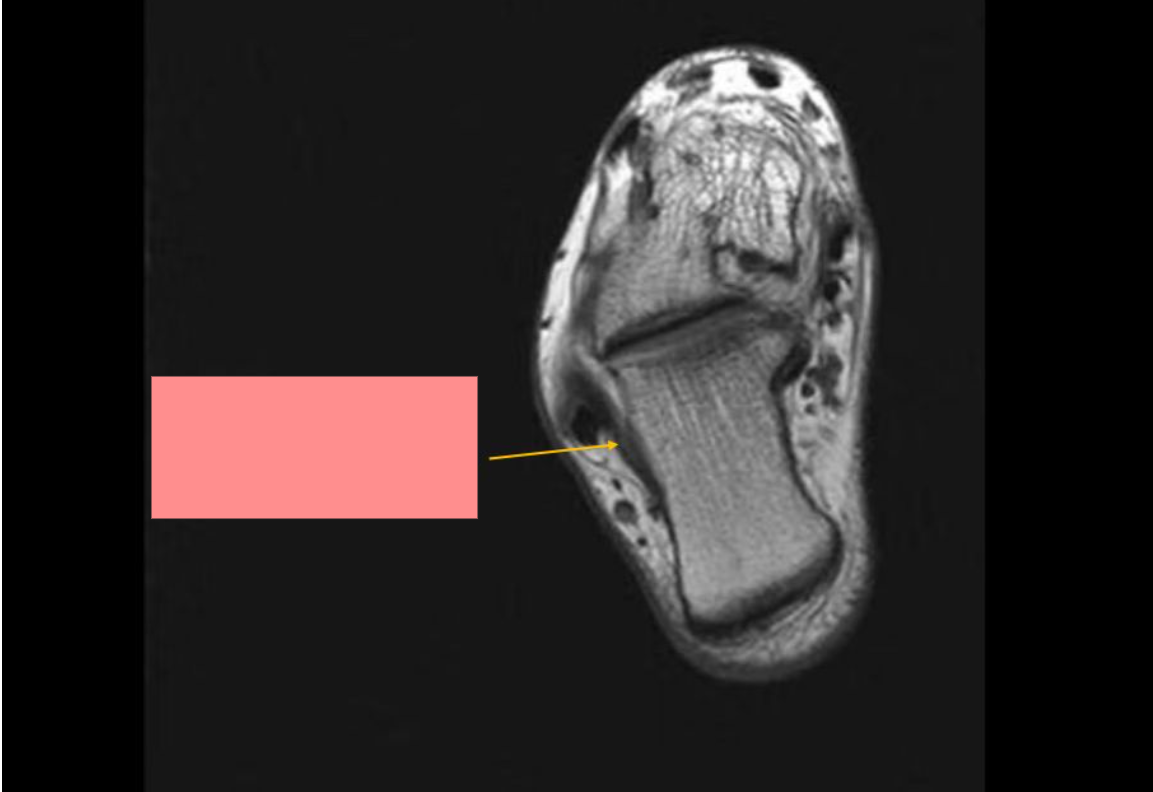 <p>Identify the structure</p>