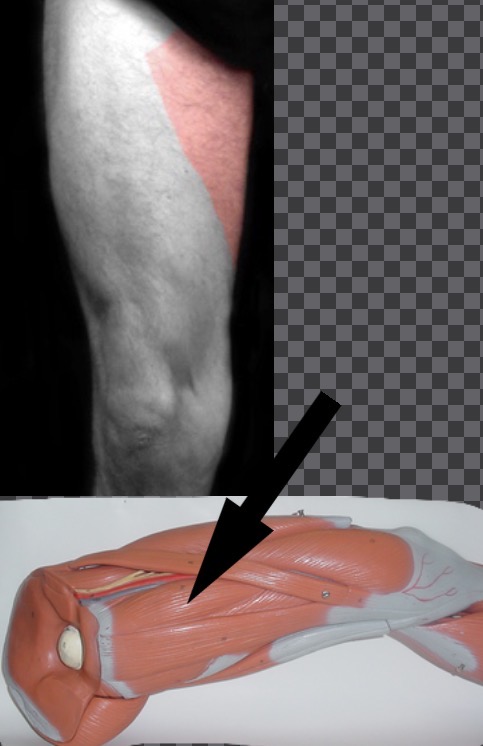 <p>What muscle is this?</p>