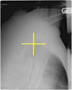 <p>Swimmers: Is this Image Good?</p>