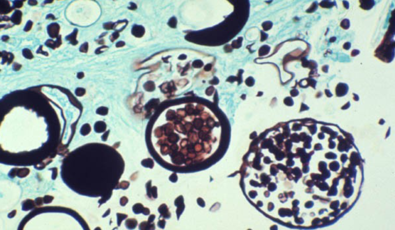 <p>Identify the Fungus</p>