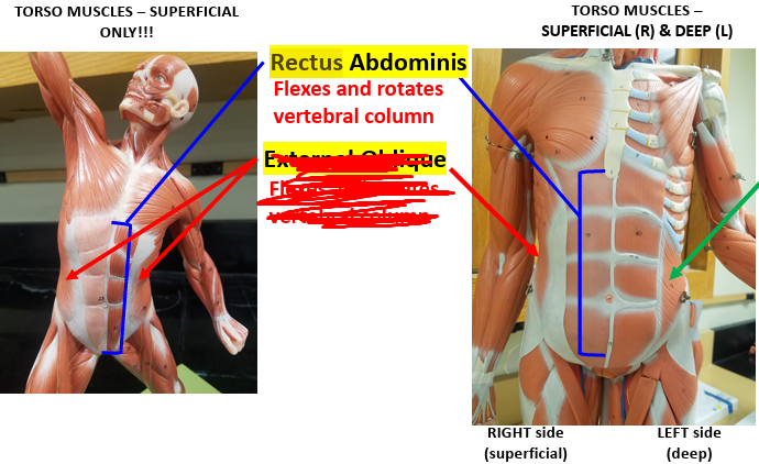 <p><strong>Origin: </strong>Pubic crest.<strong><br>Insertion: </strong>Xiphoid process.<strong><br>Action: </strong>Flexes trunk.<strong><br>Synergist: </strong>External oblique.</p><p><span style="color: rgb(225, 8, 8);"><strong>Antagonist: </strong></span><span style="color: rgb(248, 248, 248);">Erector spinae.</span></p>