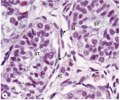 <p>What covers the basement membrane of the seminiferous tubules?</p>