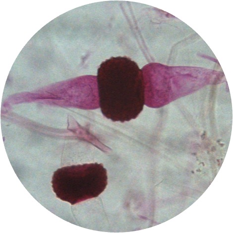 <p>This type of fungi is similarly shaped as round in the center with two tails on each end; reproduce through zygospores</p>