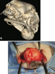 <p>This benign non-odontogenic tumor occurs in cats or dogs as a well circumscribed, firm raised bone lesion. Shows normal woven bone on histopath. Common on hard palate, zygomatic arch, caudal mandible.</p>