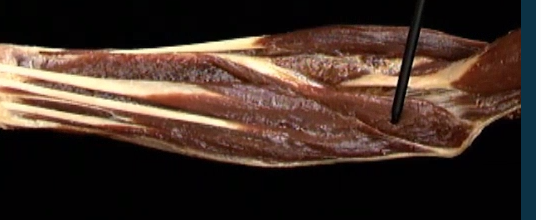 <p>Onder arm, anterior zicht</p>