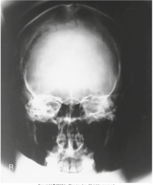 <p><span><span>The radiograph shown is</span></span></p>