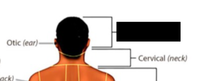 <p>what anatomical region is this?</p>