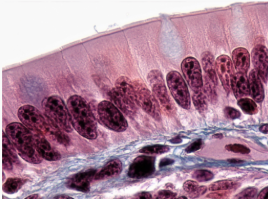 <p>what tissue is this</p>