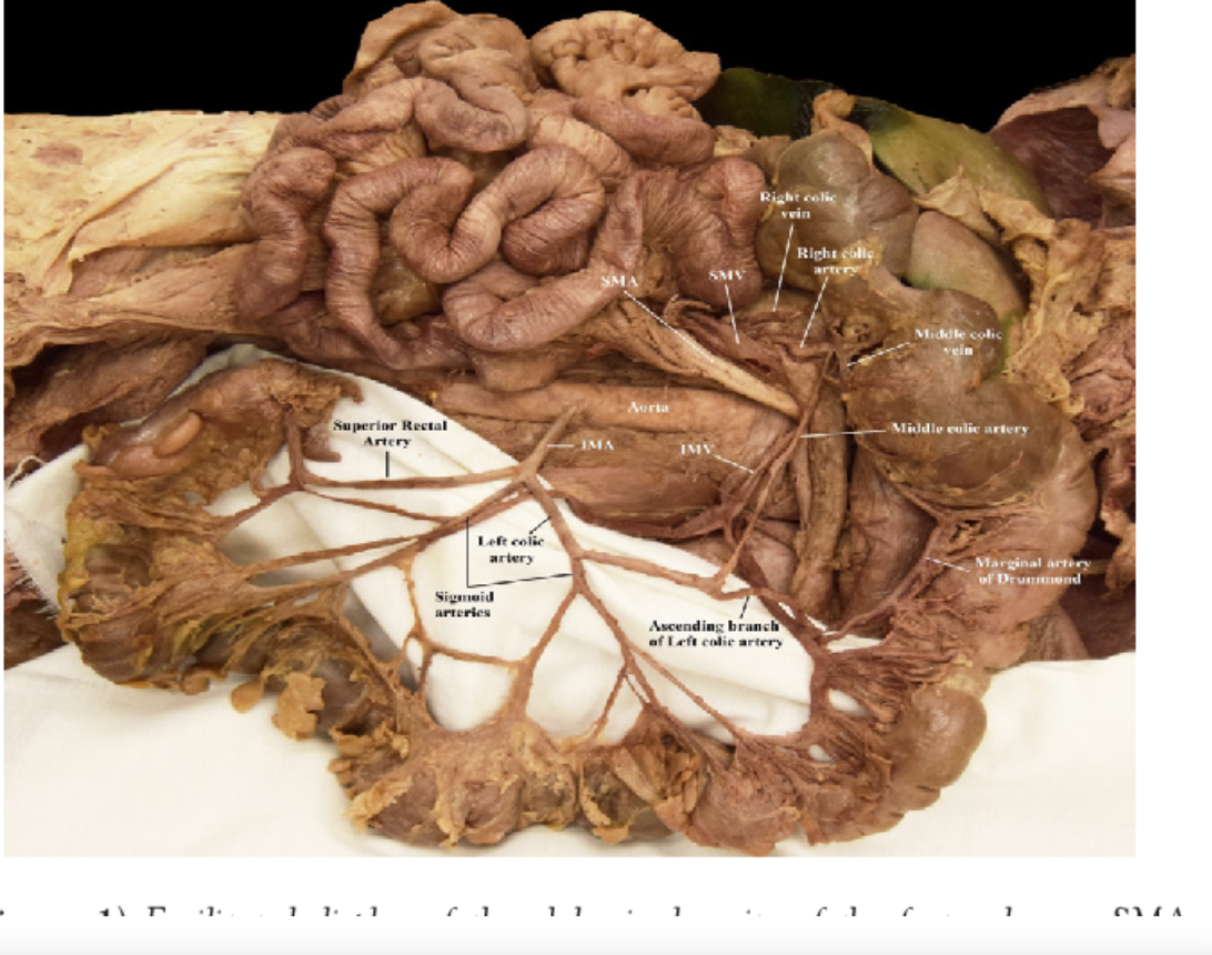 <p>along the inner margin of the colon</p><p>ta will flip descending colon </p><p>dark line on colon inner boarder</p><ul><li><p>structure</p></li></ul><p></p>