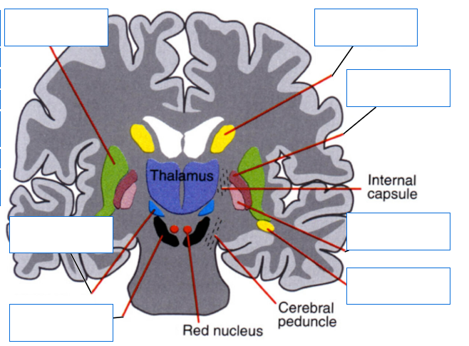 <p>Label this image </p>