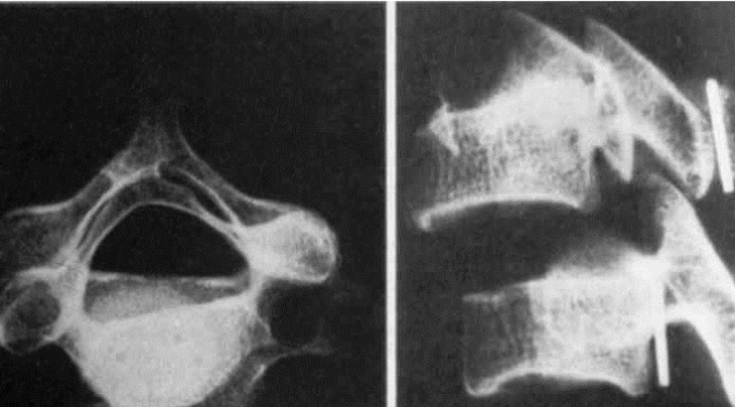 <p>What is the finding &amp; diagnosis?</p>