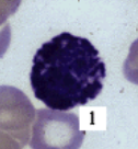 <p>What kind of WBC is this?</p>