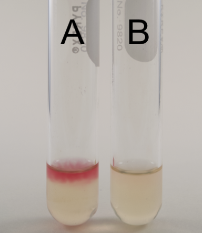 <p>What is the name of the test, purpose, media, inoculation guide, incubation, theory, and results?</p>