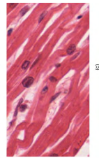 <p>long, BRANCHED</p><p>striated</p><p>1 nuclei, involuntary found in heart!</p>