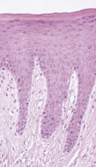 <p>- shows narrow, darkly staining granular layer in gingiva</p><p>- gingiva, hard palate, some areas of dorsal tongue</p>