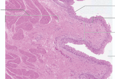 <p>picture of what?</p><p></p><p>word bank</p><p>urothelium</p><p>lumen</p><p>detrusor muscle</p><p>rounded apical urothelium cell</p><p>lamina propria</p>