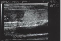 <p>What is this? (jugular vein)</p>