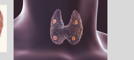 <p>located in the neck region (near thyroid) produces PTH (parathyroid hormone) to regulate blood calcium and phosphate levels</p>