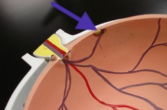 <p>Part of retina with only cones; greatest visual acuity here</p>