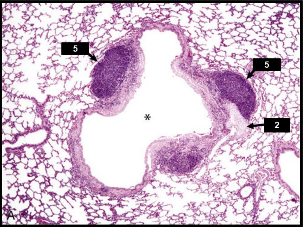 <p>Name the structure indicated by 5.</p>