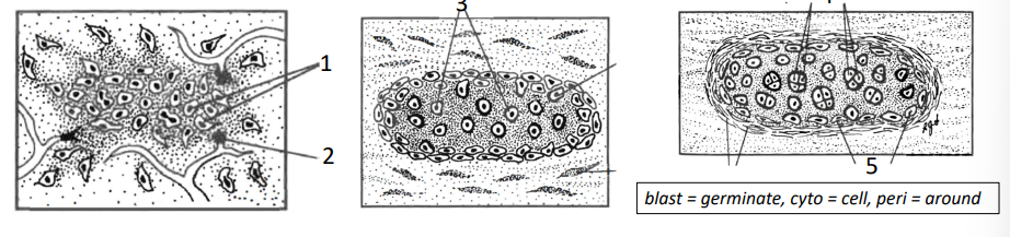 <p>1. Cartilage stem cells (chondroblasts) condense, proliferate & differentiate into cartilage cells (chondrocytes) at the centre of chondrification in week 5.</p><p>2. Blood vessels regress (cartilage = avascular; limits size of cartilage) </p><p>3. Chondrocytes secrete a gelatinous matrix around themselves separating the cells </p><p>4. Chondrocytes divide, creating nests surrounded by matrix </p><p>5. Cartilage grows by adding cells from its external surface (perichondrium)</p>