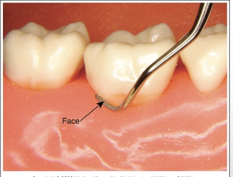 <p>It is vital for effective calculus removal</p>