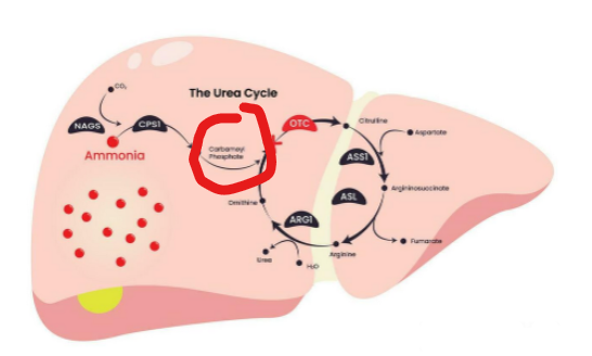 <p>What does the severity of OTC deficiency depend on</p>
