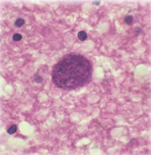 <p>DORMANT phase (brady just sounds round and sleepy)</p><p>Bradyzoites are FOUND INSIDE OF CYSTS</p>